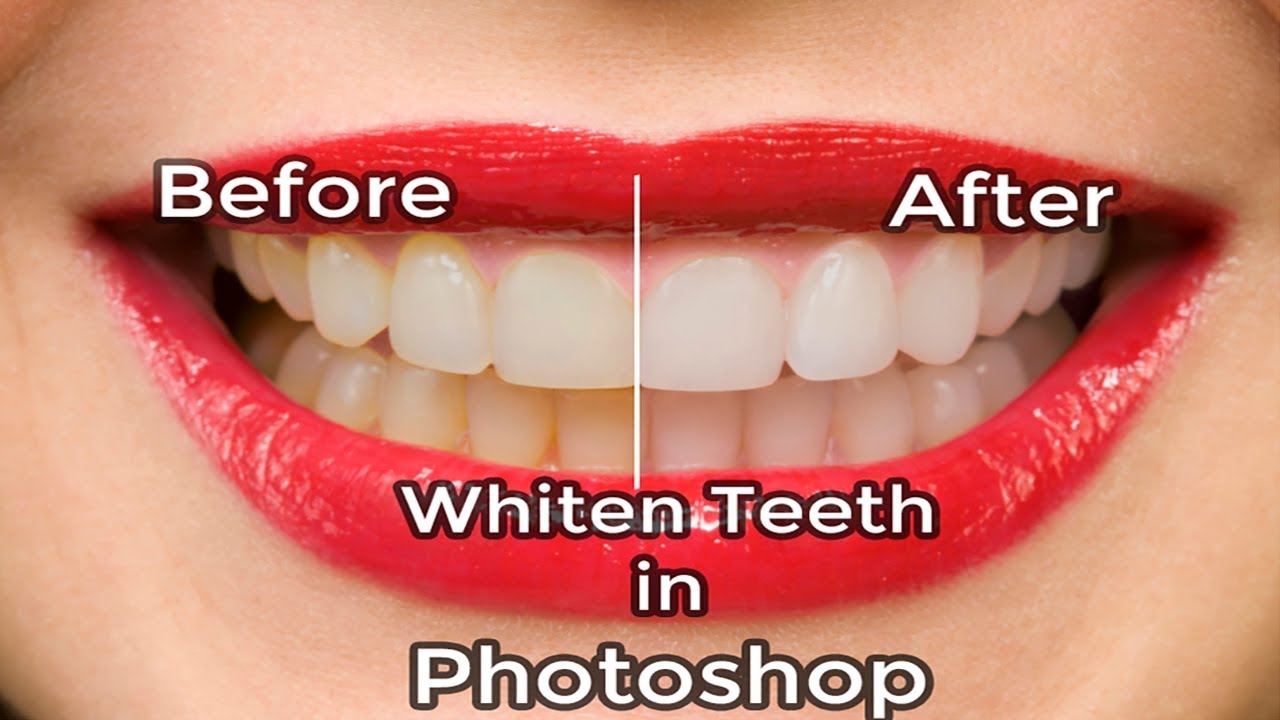 Whiten Teeth in Photoshop | Photoshop Tutorial | Adobe Photoshop CC