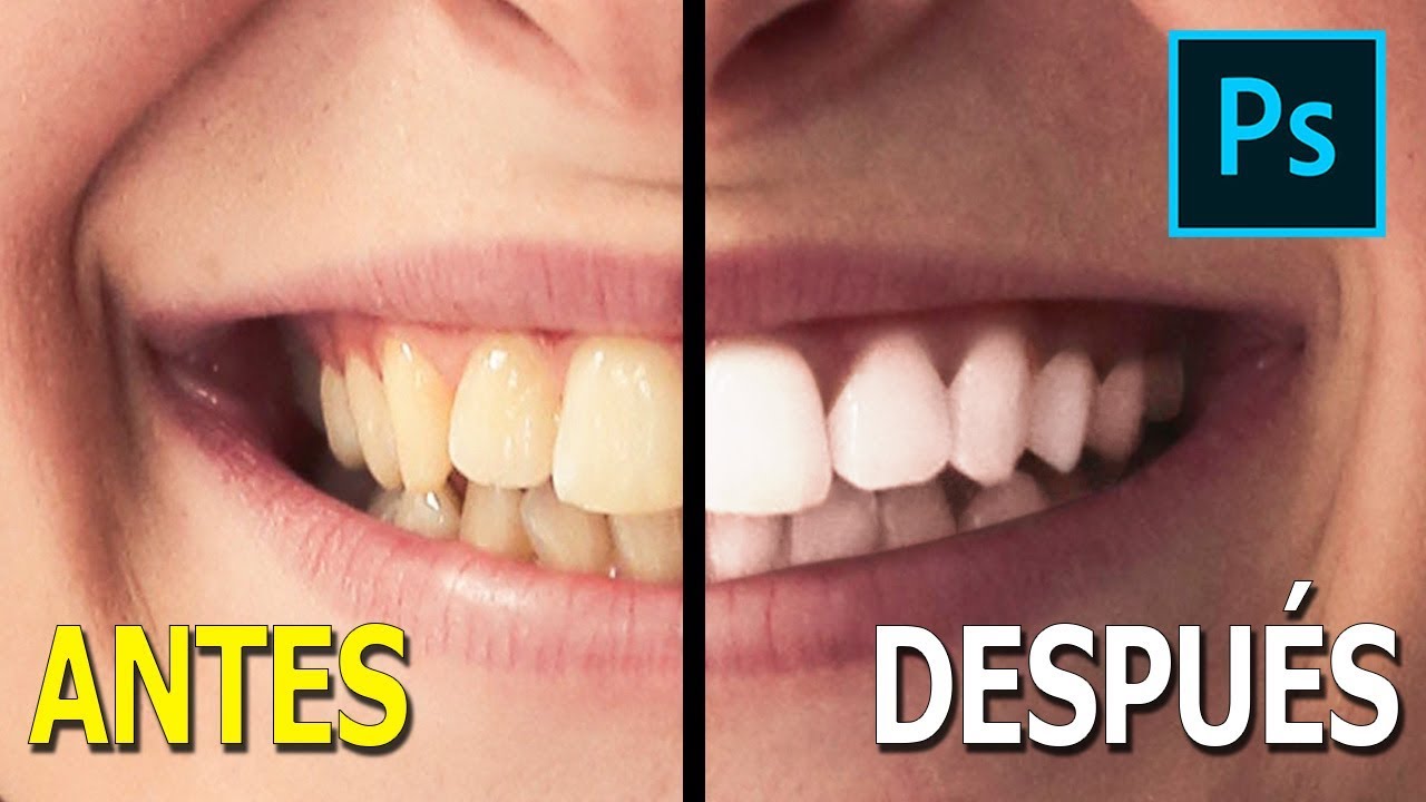 Blanquear Dientes | Photoshop Tutorial